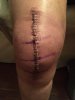 knee3.JPG