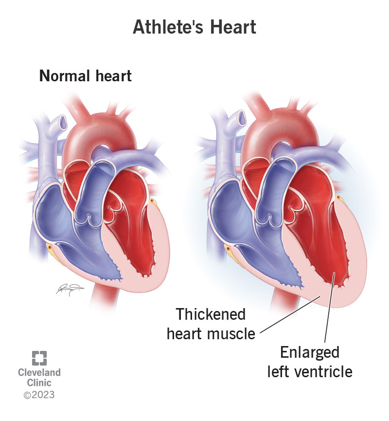 my.clevelandclinic.org