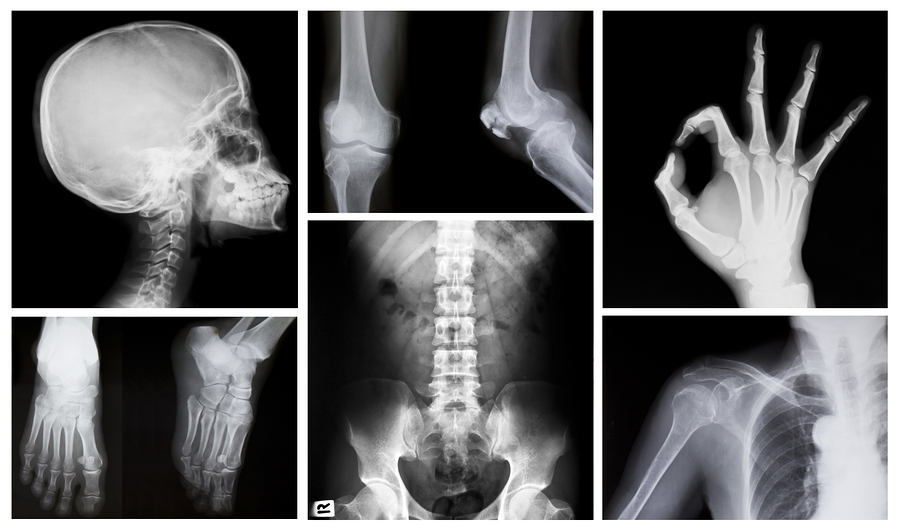 X-ray-Day.jpg